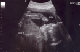 J.D. body