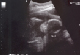 J.D. face