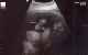 J.D. foot